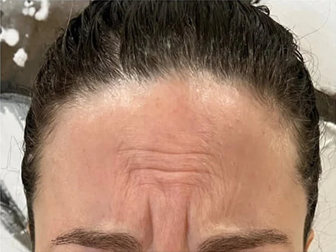 Before Image